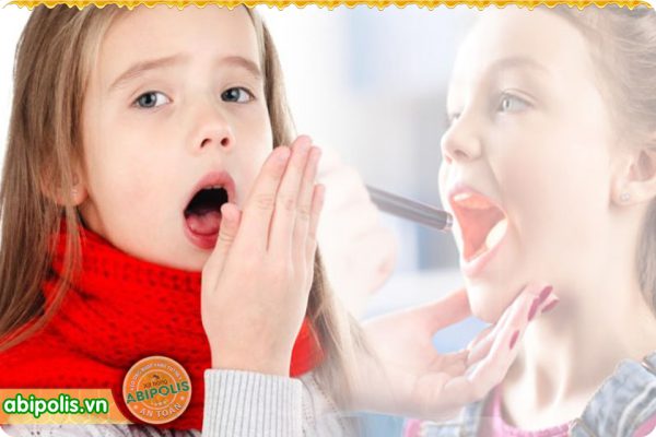 Dấu hiệu nhận biết khi trẻ bị viêm họng và nguyên nhân