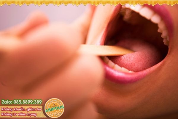 Hiểu đúng về viêm họng cấp để điều trị hiệu quả hơn