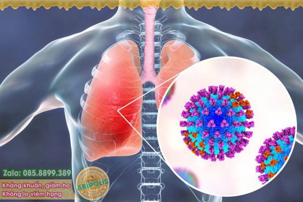 Nấm phổi do Aspergillus: Bệnh nguy hiểm nhưng ít người biết