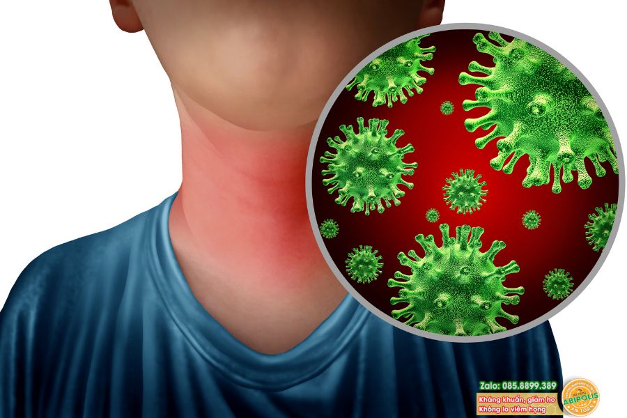 Vì sao trẻ hay bị viêm họng tái phát? Bố mẹ cần làm gì để khắc phục