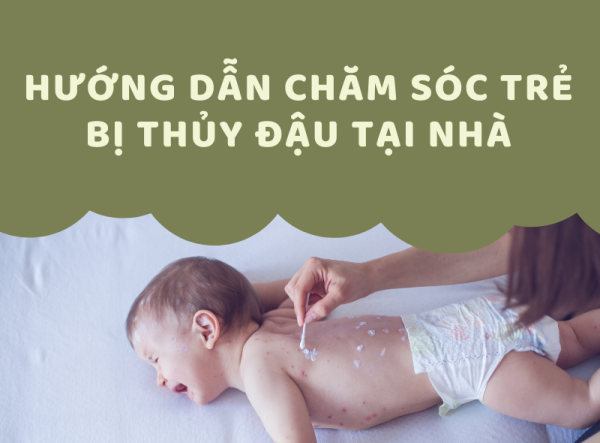 [INFOGRAPHIC] HƯỚNG DẪN CHĂM SÓC TRẺ BỊ THỦY ĐẬU TẠI NHÀ